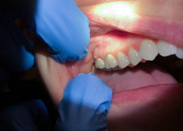 Best Same-Day Emergency Dental Services in Rose Hill, NC